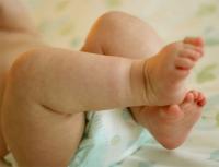 Методы лечения опрелостей у новорожденных детей